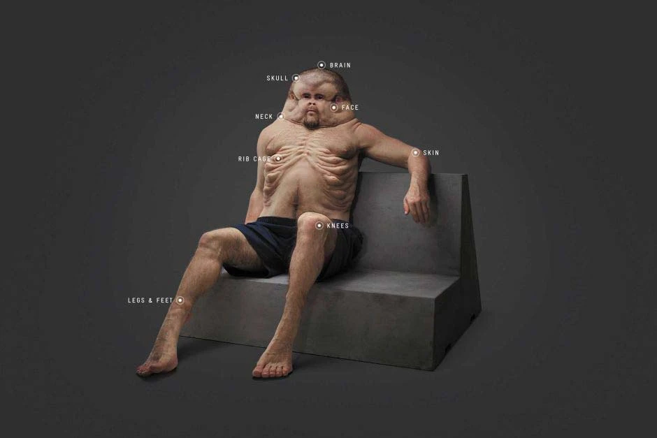 graham can withstand a car accident